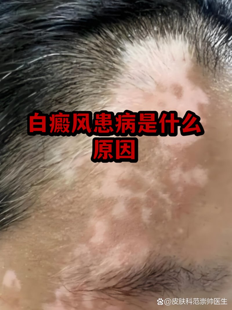 警惕误区：理性看待皮肤健康