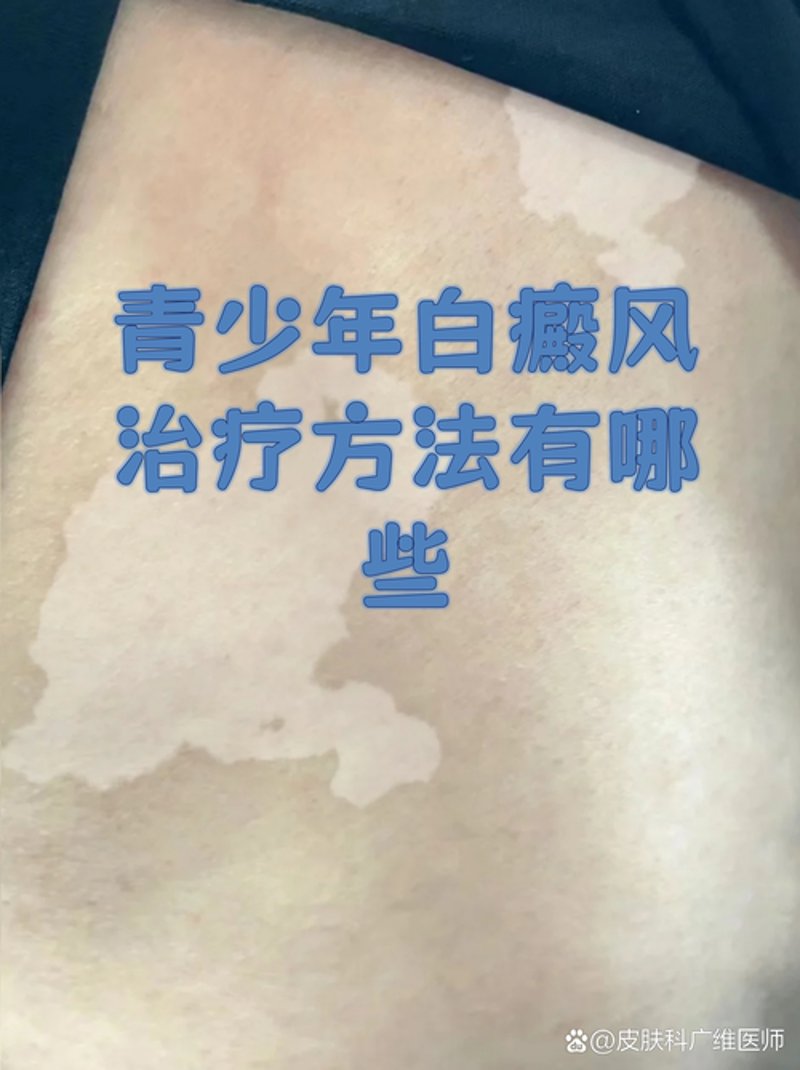 中研皮肤病医院：助力皮肤健康，重拾光彩肌肤