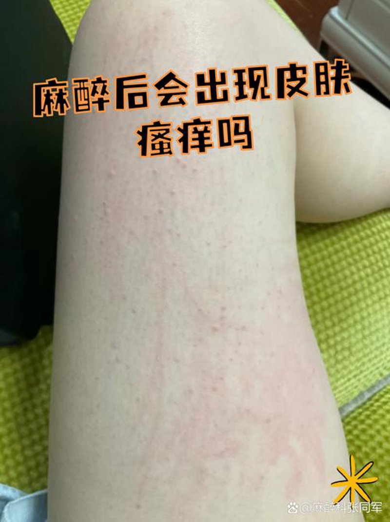 选好医院，健康无忧：中研皮肤病医院的全面选购指南