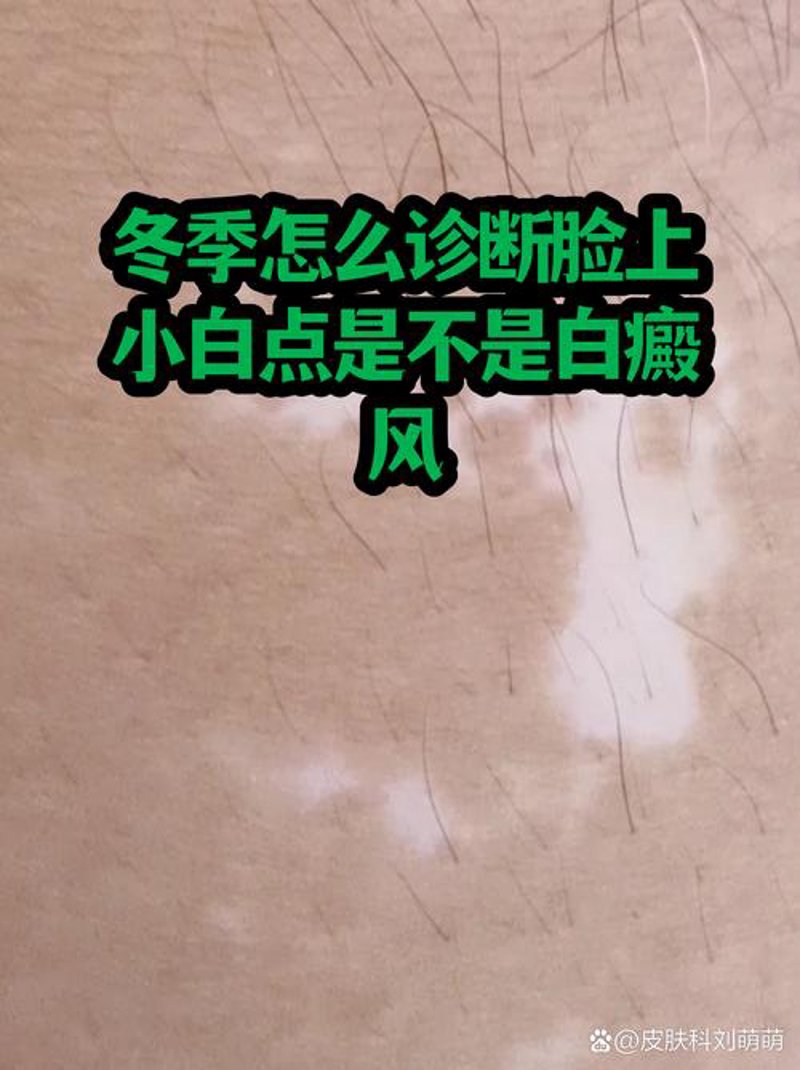 警惕！这些误区让皮肤病治疗效果大打折扣