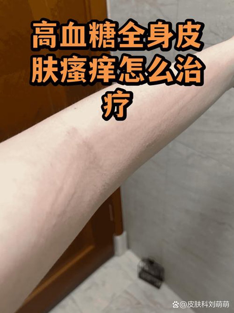 遇见中研皮肤病医院：专业的治疗体验