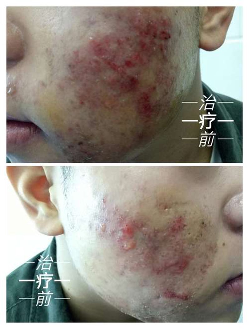 中研皮肤病医院：助力皮肤健康，重拾光彩肌肤