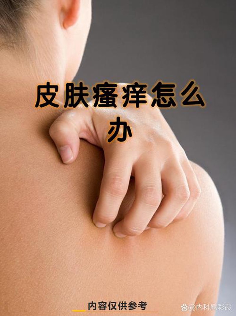 济南看皮肤