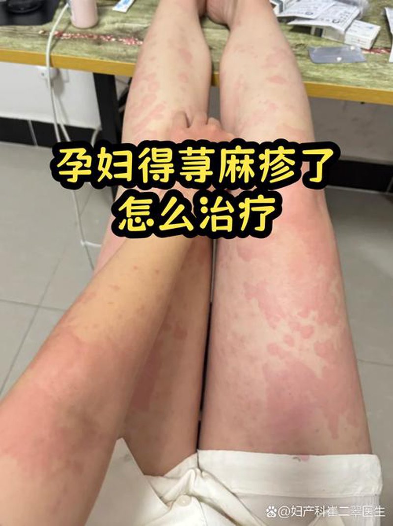 济南皮肤病医院:探寻皮肤健康的守护者